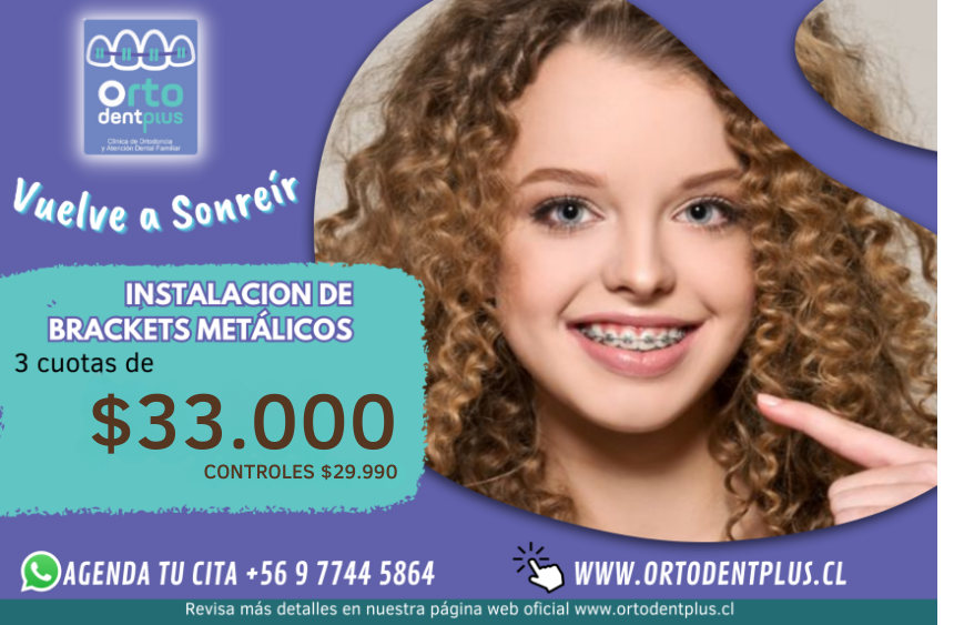 = $33.000 CONTROLES $29.000 (1)